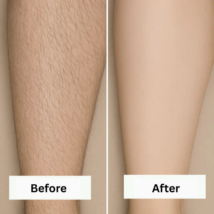 Removely IPL 3+ (Try & Buy Italy)