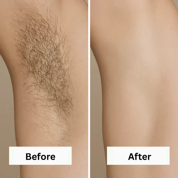 Removely IPL 3+ (Try & Buy Italy)