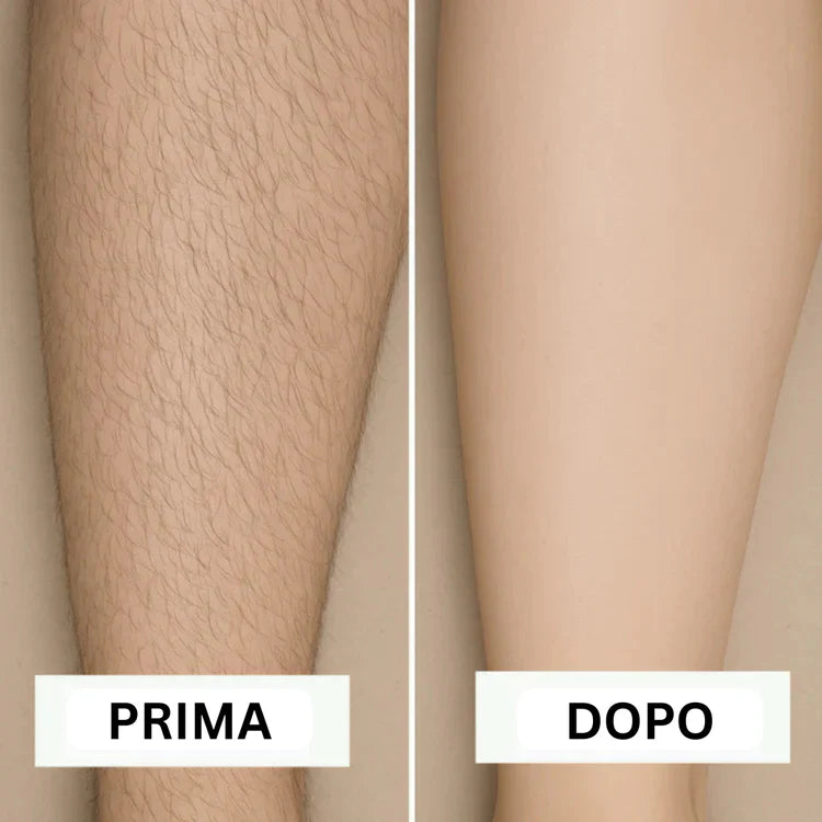 Removely IPL 3+ (Try & Buy Italy)